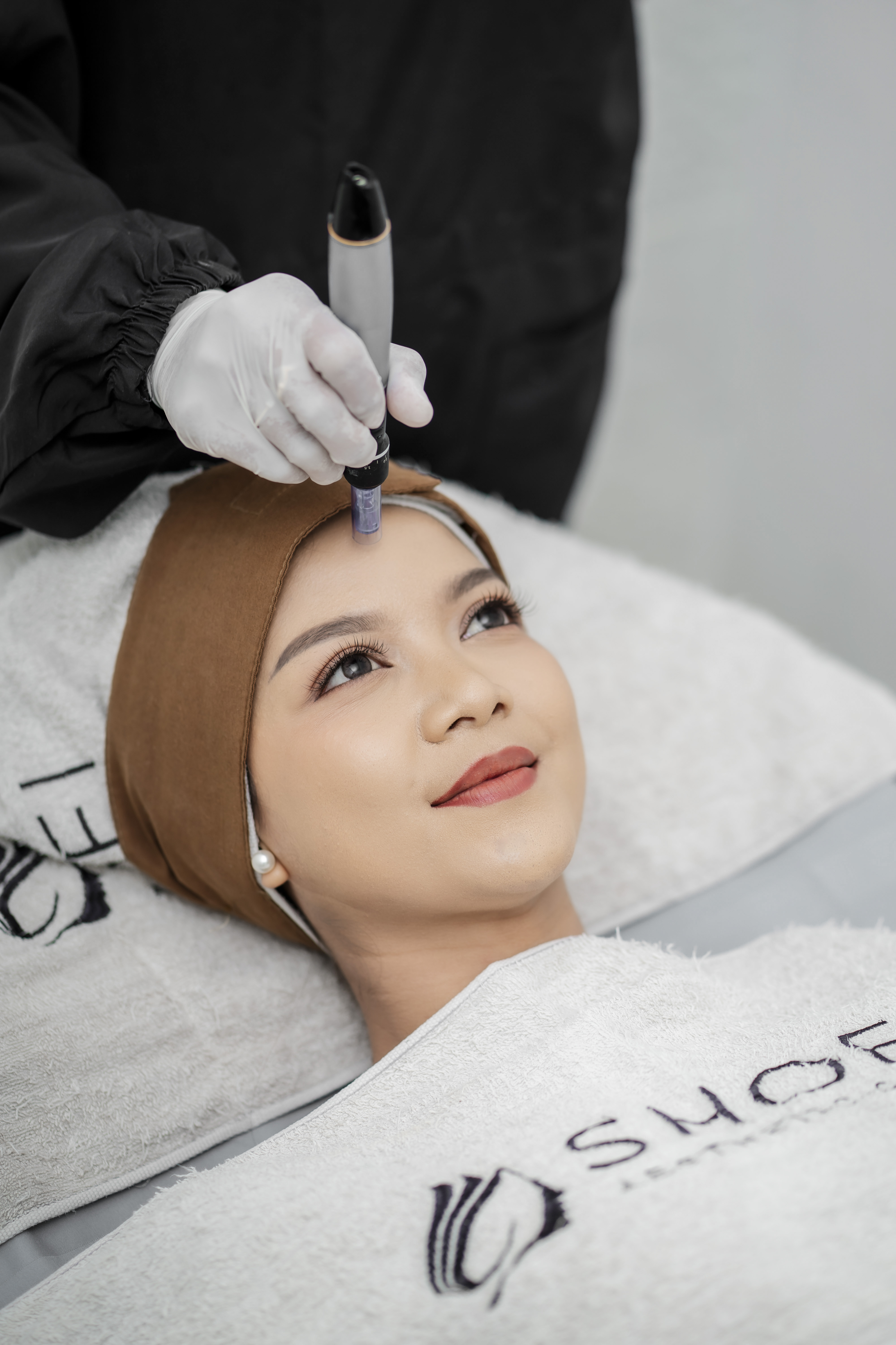 Facial PRP Dermapen